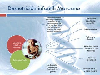 Desnutrición infantil: Marasmo
Carencia
calórica-
proteica
Bajo peso/talla
Manifestaciones
clínicas:
Emaciación: con un
peso corporal menor
del 60% de la
media o menor del
70 % del peso ideal
para la altura y
reservas de grasa
corporal agotadas
Cabeza de
apariencia
grande
Edema ausente
Piel seca y
delgada
Pelo fino, ralo y
se arranca con
facilidad
Apatía y
debilidad
Bradicardia y
hipotermia
(malnutrición
grave)
Perdida de TCS
y masa magra
 