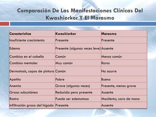 Comparación De Las Manifestaciones Clínicas Del
Kwashiorkor Y El Marasmo
Característica Kwashiorkor Marasmo
Insuficiente crecimiento Presente Presente
Edema Presente (algunas veces leve) Ausente
Cambios en el cabello Común Menos común
Cambios mentales Muy común Raros
Dermatosis, copos de pintura Común No ocurre
Apetito Pobre Bueno
Anemia Grave (algunas veces) Presente, menos grave
Grasa subcutánea Reducida pero presente Ausente
Rostro Puede ser edematoso Macilento, cara de mono
Infiltración grasa del hígado Presente Ausente
 