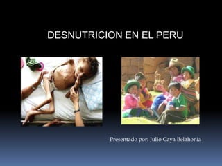 DESNUTRICION EN EL PERU Presentado por: Julio Caya Belahonia 