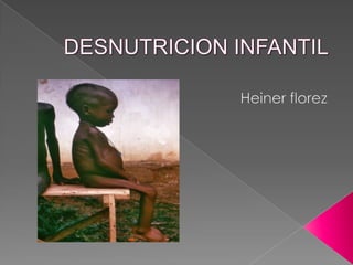 DESNUTRICION INFANTIL Heiner florez 