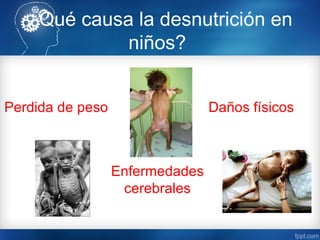 ¿Qué causa la desnutrición en
             niños?


Perdida de peso                  Daños físicos



                  Enfermedades
                   cerebrales
 
