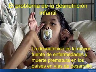 El problema de la desnutrición
           infantil




        La desnutrición es la mayor
        fuente de enfermedades y
        muerte prematura en los
        países en vías de desarrollo
 