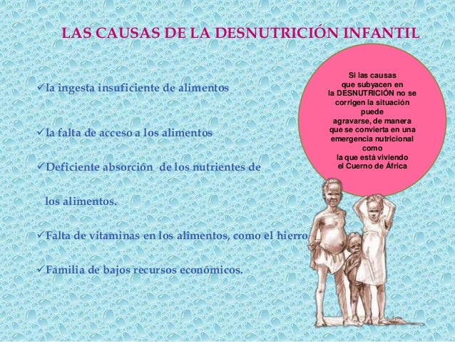 Desnutricion infantil