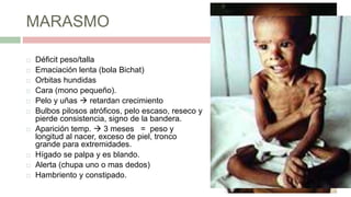 Muy afectado;
 signos vitales
deprimidos
 flácido y
apático
 hipoglucemia
e hipotermia.
MARASMO
 Déficit peso/talla
 Emaciación lenta (bola Bichat)
 Orbitas hundidas
 Cara (mono pequeño).
 Pelo y uñas  retardan crecimiento
 Bulbos pilosos atróficos, pelo escaso, reseco y
pierde consistencia, signo de la bandera.
 Aparición temp.  3 meses = peso y
longitud al nacer, exceso de piel, tronco
grande para extremidades.
 Hígado se palpa y es blando.
 Alerta (chupa uno o mas dedos)
 Hambriento y constipado.
 