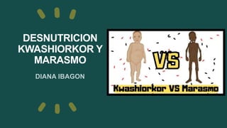 DESNUTRICION
KWASHIORKOR Y
MARASMO
DIANA IBAGON
 