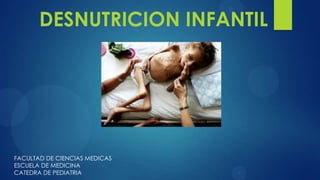 DESNUTRICION INFANTIL




FACULTAD DE CIENCIAS MEDICAS
ESCUELA DE MEDICINA
CATEDRA DE PEDIATRIA
 