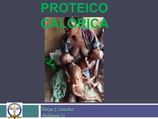PROTEICO
CALÓRICA




Tanya J. Sanchez
Pediatria II
 