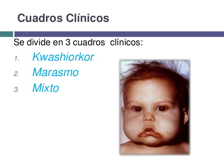 Signo De La Bandera En El Cabello es.slideshare.net