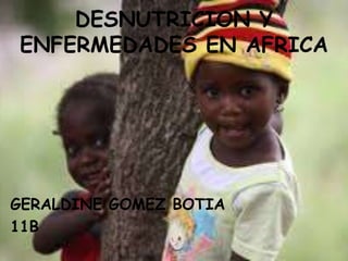 DESNUTRICION Y
ENFERMEDADES EN AFRICA
GERALDINE GOMEZ BOTIA
11B
 