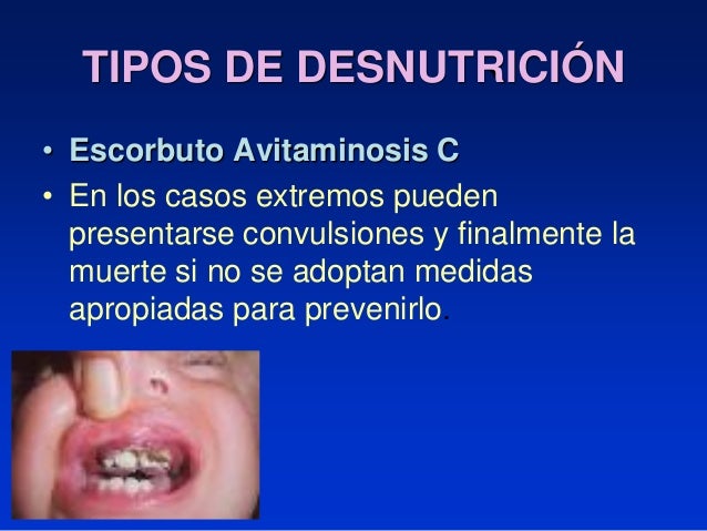 El lago baskunchak de la psoriasis