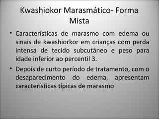 Kwashiokor Marasmático- Forma
Mista
• Características de marasmo com edema ou
sinais de kwashiorkor em crianças com perda
intensa de tecido subcutâneo e peso para
idade inferior ao percentil 3.
• Depois de curto período de tratamento, com o
desaparecimento do edema, apresentam
características típicas de marasmo
 