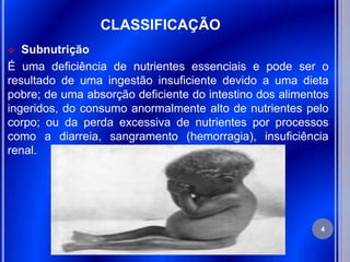 CLASSIFICAÇÃO
  Subnutrição
É uma deficiência de nutrientes essenciais e pode ser o
resultado de uma ingestão insuficiente devido a uma dieta
pobre; de uma absorção deficiente do intestino dos alimentos
ingeridos, do consumo anormalmente alto de nutrientes pelo
corpo; ou da perda excessiva de nutrientes por processos
como a diarreia, sangramento (hemorragia), insuficiência
renal.




                                                          4
 