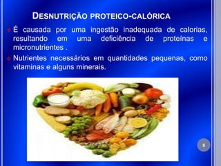 DESNUTRIÇÃO PROTEICO-CALÓRICA
 É causada por uma ingestão inadequada de calorias,
  resultando em uma deficiência de proteínas e
  micronutrientes .
 Nutrientes necessários em quantidades pequenas, como
  vitaminas e alguns minerais.




                                                    6
 