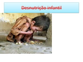 Desnutrição infantil