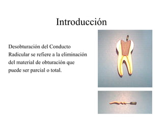 Introducción
La obturación endodóntica es el
sellado del conducto dentinario en
amplitud y longitud con un material
biocom...