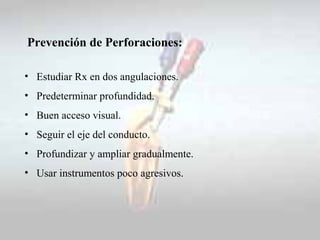 Prevención de Perforaciones:
• Estudiar Rx en dos angulaciones.
• Predeterminar profundidad.
• Buen acceso visual.
• Segui...