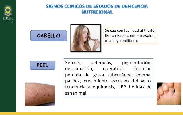 Desordenes nutricionales en el adolescente Desordenes nutricionales en el adolescente
