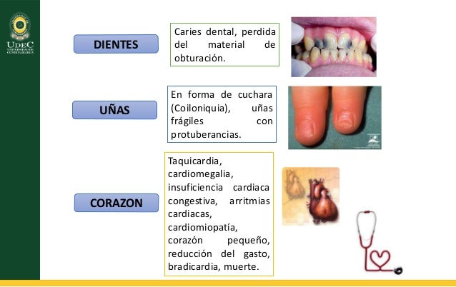 Desordenes nutricionales en el adolescente Desordenes nutricionales en el adolescente
