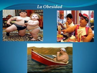 La Obesidad
 