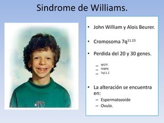 • John William y Alois Beurer.
• Cromosoma 7q11.23
• Perdida del 20 y 30 genes.
– WSTF.
– FKBP6
– 7q11.2
• La alteración se encuentra
en:
– Espermatozoide
– Ovulo.
Sindrome de Williams.
 