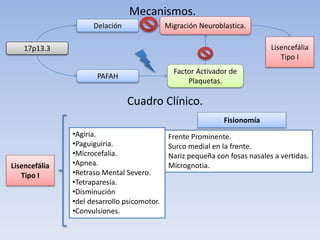 Mecanismos.
17p13.3
Delación
PAFAH
Factor Activador de
Plaquetas.
Migración Neuroblastica.
Lisencefália
Tipo I
Cuadro Clínico.
Lisencefália
Tipo I
•Agiria.
•Paguiguiria.
•Microcefalia.
•Apnea.
•Retraso Mental Severo.
•Tetraparesía.
•Disminución
•del desarrollo psicomotor.
•Convulsiones.
Fisionomía
Frente Prominente.
Surco medial en la frente.
Nariz pequeña con fosas nasales a vertidas.
Micrognotia.
 