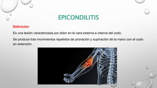 EPICONDILITIS
Definición:
Es una lesión caracterizada por dolor en la cara externa e interna del codo.
Se produce tras movimientos repetidos de pronación y supinación de la mano con el codo
en extensión.
 