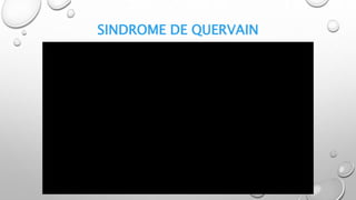 SINDROME DE QUERVAIN
 