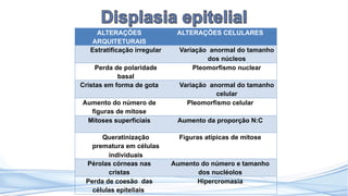 ALTERAÇÕES
ARQUITETURAIS
ALTERAÇÕES CELULARES
Estratificação irregular Variação anormal do tamanho
dos núcleos
Perda de polaridade
basal
Pleomorfismo nuclear
Cristas em forma de gota Variação anormal do tamanho
celular
Aumento do número de
figuras de mitose
Pleomorfismo celular
Mitoses superficiais Aumento da proporção N:C
Queratinização
prematura em células
individuais
Figuras atípicas de mitose
Pérolas córneas nas
cristas
Aumento do número e tamanho
dos nucléolos
Perda de coesão das
células epiteliais
Hipercromasia
 