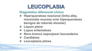 Diagnóstico diferencial clínico
Hiperqueratose reacional (linha alba,
morsicatio mucosa oris/ hiperqueratose
benigna de rebordo alveolar)
Líquen plano
Lupus eritematoso
Nevo branco esponjoso/ leucoedema
Candidose
Leucoplasia pilosa
 