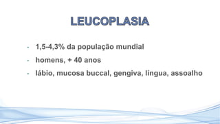 • 1,5-4,3% da população mundial
• homens, + 40 anos
• lábio, mucosa buccal, gengiva, língua, assoalho
 