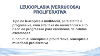Tipo de leucoplasia multifocal, persistente e
progressiva, com alta taxa de recorrência e alto
risco de progressão para carcinoma de células
escamosas
Sinonímia: leucoplasia proliferativa, leucoplasia
multifocal proliferativa
 