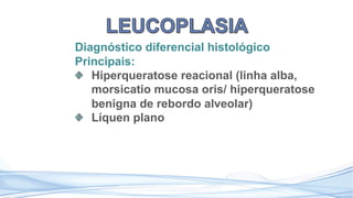 Diagnóstico diferencial histológico
Principais:
Hiperqueratose reacional (linha alba,
morsicatio mucosa oris/ hiperqueratose
benigna de rebordo alveolar)
Líquen plano
 