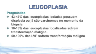 Prognóstico
43-47% das leucoplasias isoladas possuem
displasia ou já são carcinomas no momento da
biópsia
10-18% das leucoplasias localizadas sofrem
transformação maligna
50-100% das LVP sofrem transformação maligna
 