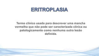 Termo clínico usado para descrever uma mancha
vermelha que não pode ser caracterizada clínica ou
patologicamente como nenhuma outra lesão
definida.
 