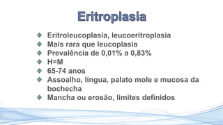 Eritroleucoplasia, leucoeritroplasia
Mais rara que leucoplasia
Prevalência de 0,01% a 0,83%
H=M
65-74 anos
Assoalho, língua, palato mole e mucosa da
bochecha
Mancha ou erosão, limites definidos
 