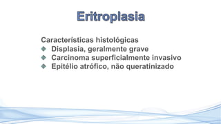 Características histológicas
Displasia, geralmente grave
Carcinoma superficialmente invasivo
Epitélio atrófico, não queratinizado
 