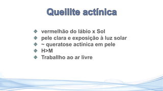vermelhão do lábio x Sol
pele clara e exposição à luz solar
~ queratose actínica em pele
H>M
Traballho ao ar livre
 