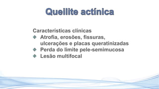 Características clínicas
Atrofia, erosões, fissuras,
ulcerações e placas queratinizadas
Perda do limite pele-semimucosa
Lesão multifocal
 