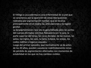 El Vitíligo o Leucoderma es una enfermedad de la piel que
se caracteriza por la aparición de áreas blanquecinas
rodeadas por pigmentación normal, que se localiza
principalmente en el rostro, las articulaciones y la región
genital.
La despigmentación rara vez es generalizada pero las partes
del cuerpo afectadas con más frecuencia son la cara, la
parte superior del tórax, las caras dorsales de las manos, las
axilas, las ingles, los ojos, la nariz, la boca, las orejas, los
codos rodillas y órganos sexuales.
Luego del primer episodio, que normalmente se da antes
de los 20 años, pueden sucederse indefinidamente ciclos
de pérdida de pigmentación alternados con momentos de
estabilidad en los que no hay cambios visibles.
 