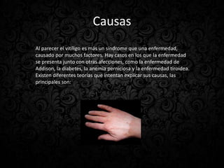 Causas
Al parecer el vitíligo es más un síndrome que una enfermedad,
causado por muchos factores. Hay casos en los que la enfermedad
se presenta junto con otras afecciones, como la enfermedad de
Addison, la diabetes, la anemia perniciosa y la enfermedad tiroidea.
Existen diferentes teorías que intentan explicar sus causas, las
principales son:
 