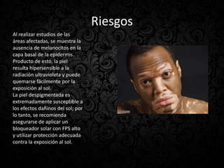 Riesgos
Al realizar estudios de las
áreas afectadas, se muestra la
ausencia de melanocitos en la
capa basal de la epidermis.
Producto de esto, la piel
resulta hipersensible a la
radiación ultravioleta y puede
quemarse fácilmente por la
exposición al sol.
La piel despigmentada es
extremadamente susceptible a
los efectos dañinos del sol; por
lo tanto, se recomienda
asegurarse de aplicar un
bloqueador solar con FPS alto
y utilizar protección adecuada
contra la exposición al sol.
 