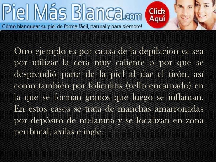 La corteza contra las manchas de pigmento