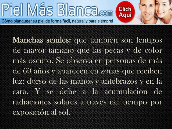 La crema el tratamiento de la pigmentación