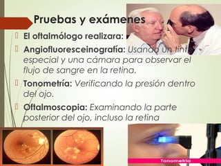 Pruebas y exámenes
 El oftalmólogo realizara:
 Angiofluoresceinografía: Usando un tinte
especial y una cámara para observar el
flujo de sangre en la retina.
 Tonometría: Verificando la presión dentro
del ojo.
 Oftalmoscopia: Examinando la parte
posterior del ojo, incluso la retina.
 