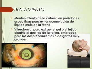 TRATAMIENTO
 Mantenimiento de la cabeza en posiciones
específicas para evitar acumulación de
líquido atrás de la retina.
 Vitrectomía: para extraer el gel o el tejido
cicatricial que tira de la retina, empleada
para los desprendimientos o desgarros muy
grandes.
 