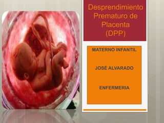 Desprendimiento
Prematuro de
Placenta
(DPP)
MATERNO INFANTIL
JOSÉ ALVARADO
ENFERMERIA
 