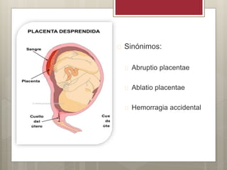 D.P.P.N.I.  Sinónimos:
 Abruptio placentae
 Ablatio placentae
 Hemorragia accidental
 