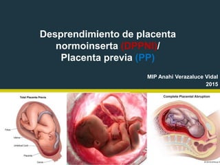 Desprendimiento de placenta
normoinserta (DPPNI)/
Placenta previa (PP)
MIP Anahi Verazaluce Vidal
2015
 