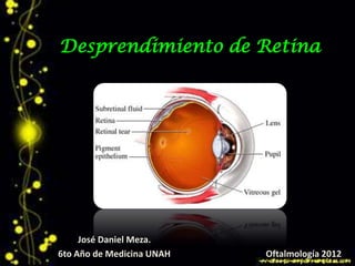 Desprendimiento de Retina




     José Daniel Meza.
6to Año de Medicina UNAH   Oftalmología 2012
 