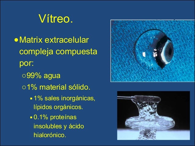 Desprendimiento de retina